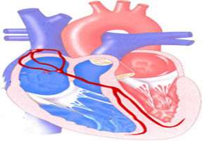 Há várias causas para a arritmia cardíaca